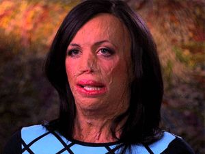 Vücudunun yüzde 65'i yanan atlet Turia'nın inanılmaz yaşam öyk