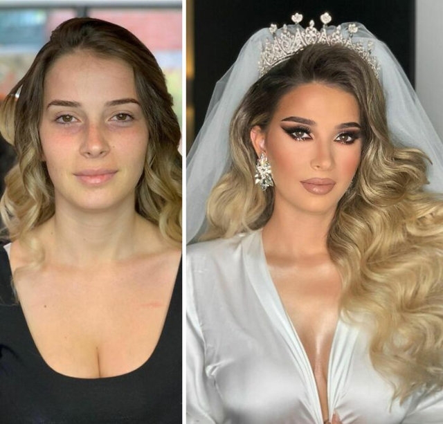 Böyle değişim görülmedi.. Gözlerinize inanamayacaksınız! 15