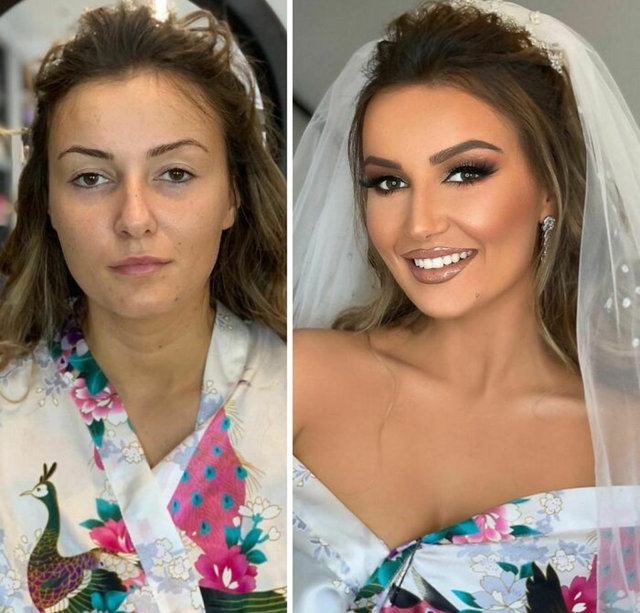 Böyle değişim görülmedi.. Gözlerinize inanamayacaksınız! 26
