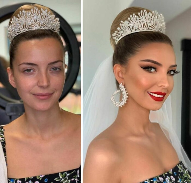 Böyle değişim görülmedi.. Gözlerinize inanamayacaksınız! 8