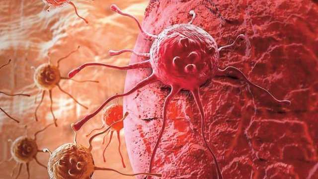 Kanserli hastanın yaşam süresi uzadı