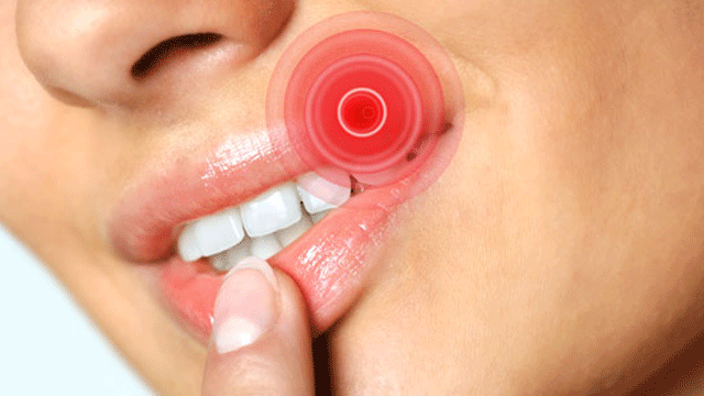 Ağız kanserleri en sık görülen kanser türlerinden