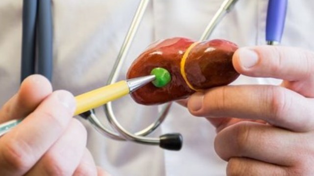 Safra kesesi taşı mı, gaz sancısı mı?