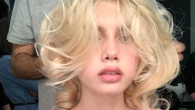 Dudaklarına Dolgu Yaptıran Aleyna Tilki'nin Son Görüntüsü Şaşırttı