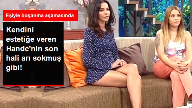 Boşanma Aşamasına Gelen Hande Ataizi, Kendini Estetiğe Verdi! Dudakları Arı Sokmuş Gibi
