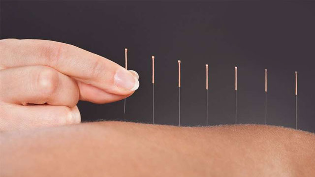 İntegratif tıp nedir? İntegratif tıp yöntemleri nelerdir?