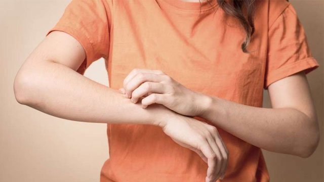 Deri hastalıkları otlarla tedavi edilir mi?