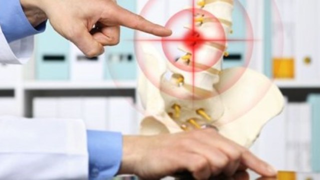 Bel fıtığı tedavisinde girişimsel işlem avantajı (Epiduroskopi nedir?)