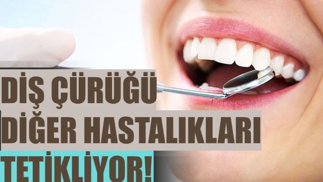Diş çürüğü diğer hastalıkları tetikliyor