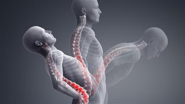 Romatizma, yaşlılık hastalığı değildir!