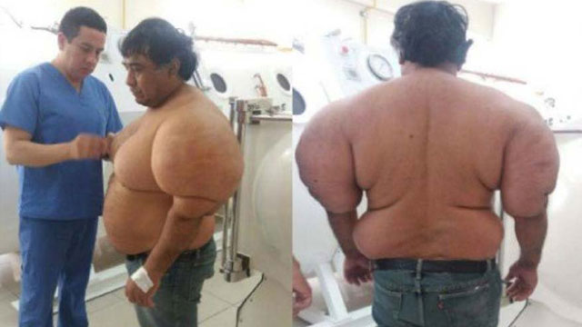 Doktorlar 4 yıldır gizemini çözemiyor! Denize daldı vücudu şişti