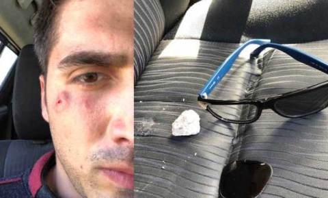 Yoldan seken taş gözüne isabet etti yaralandı