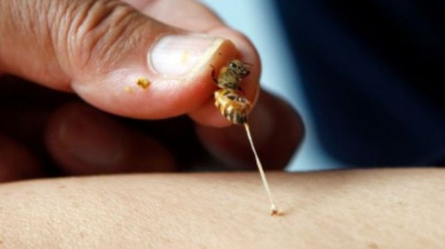 Bağışıklık sistemini arı zehri ile güçlendiriyorlar