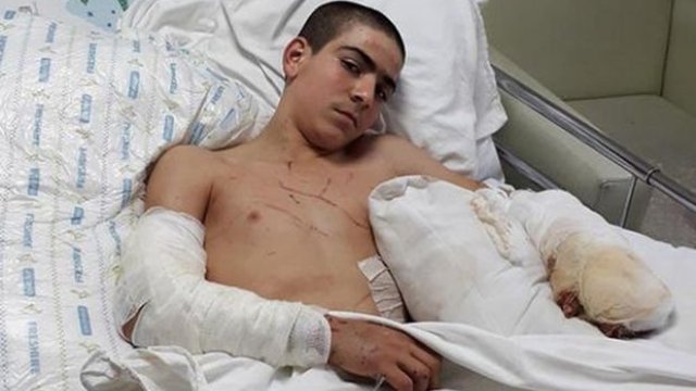 İzmir'de bir çocuğa Pitbull saldırdı