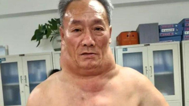 13 yaşından beri su içer gibi şarap içti son hali şoke etti!