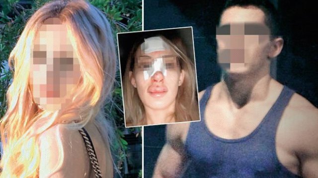 Mahkeme burun kıran eski sevgiliyi serbest bıraktı! Savcı ise...