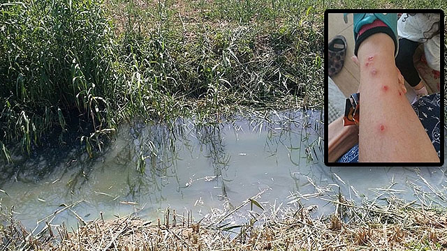 Deredeki mikrop insanlara bulaşıyor