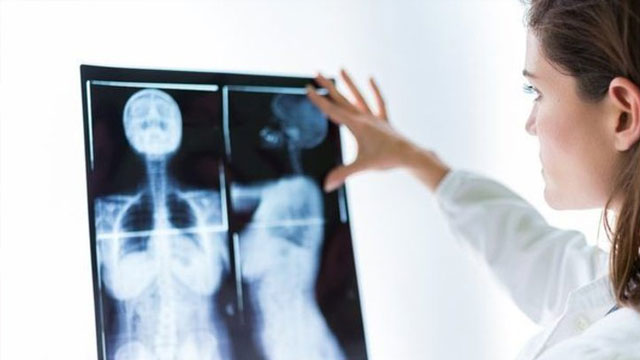 İngiltere'de göğüs taraması skandalı