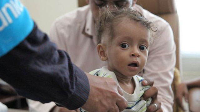 UNICEF Yemen'e 6 milyon doz aşı yardımında bulundu