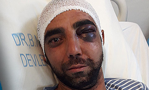 Polis’te darp iddiası!