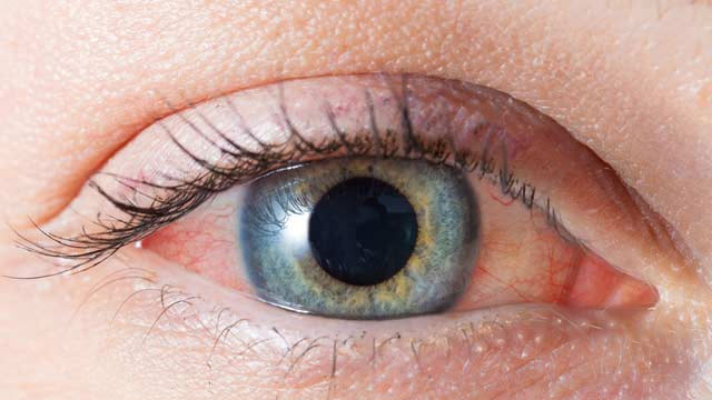 “Sinsi hastalık glokom, erken tanıyla önlenebilir"