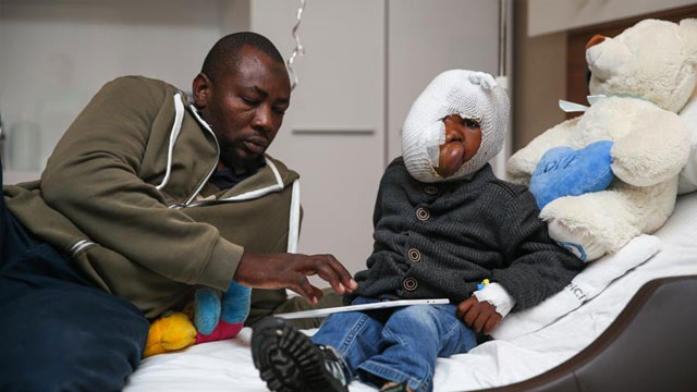 Yüzünün yarısını kaplayan tümörden Türkiye'de kurtulacak