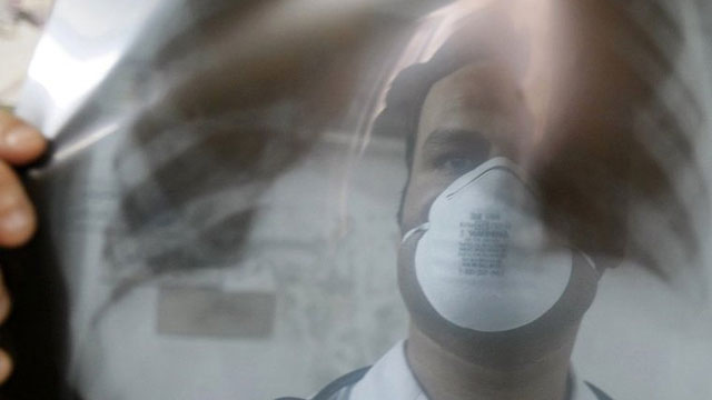 Sağlık Bakanlığı raporuna göre bu kışın belası 'gergedan virüsü'