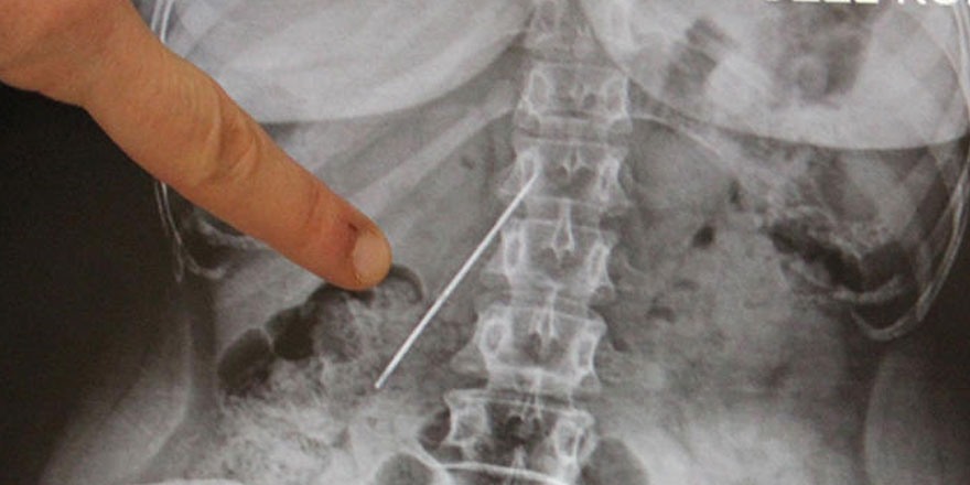 26 yıllık kâbusu sona erdi