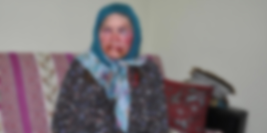 Yaşlı kadını darp edip parasını çaldılar