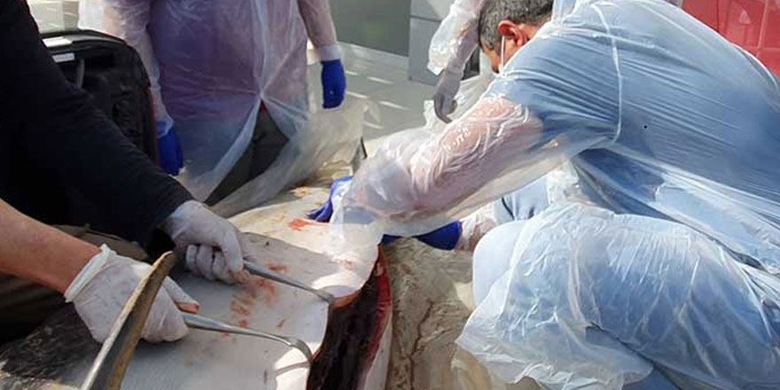 Midesinden plastik ağ çıktı