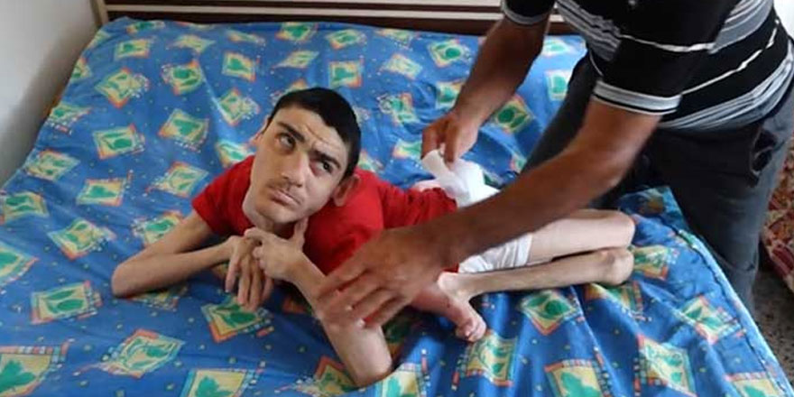 Emrah için ailesi çare bekliyor.