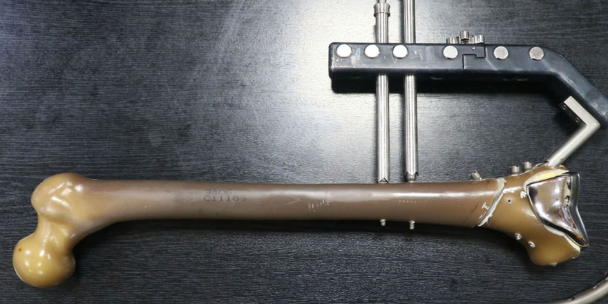 Kırık tedavileri için 'yerli çivi' üretildi