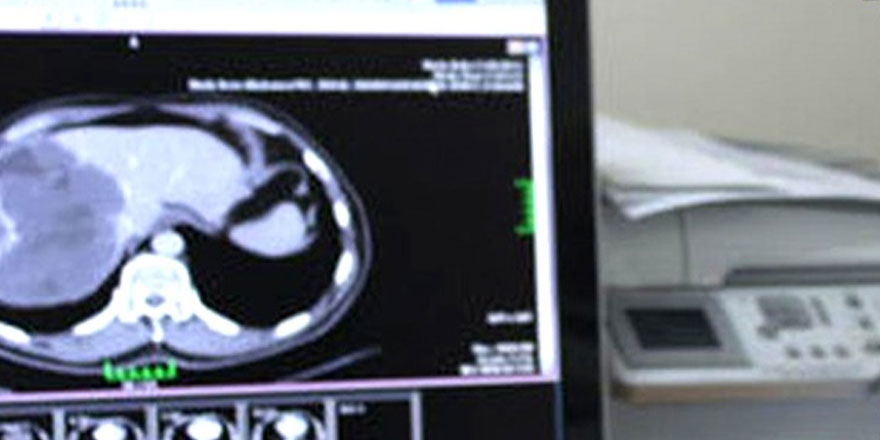 Ekinokok Hastalığı hayvanlardan insanlara bulaşıyor