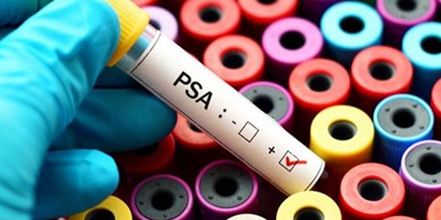 PSA testi prostat kanserinde erken tanı imkanı sağlıyor
