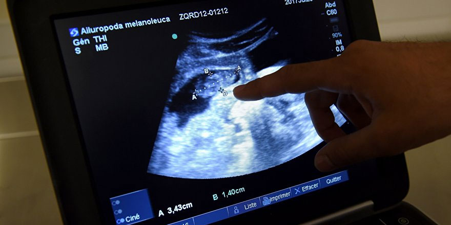 Portekiz'de yüzü olmayan bebek dünyaya geldi: Doğum uzmanı doktor açığa alındı