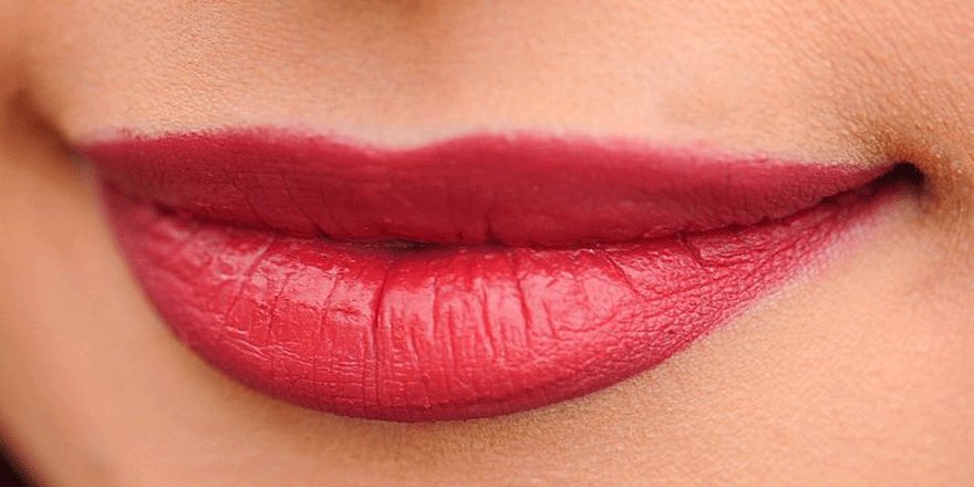 Dudak dolgusu yaptırmadan önce dikkat edilmesi gerekenler