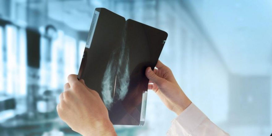 Meme kanserinin en önemli 15 belirtisi