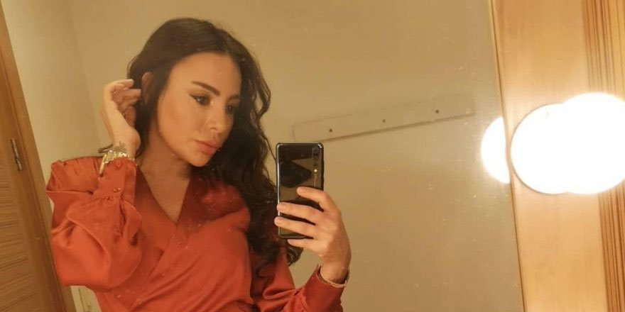 MasterChef ile ünlenen Suna Aydın, estetik yaptırdı