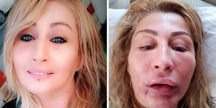 Dikkat! Estetik tuzağına düşmeyin