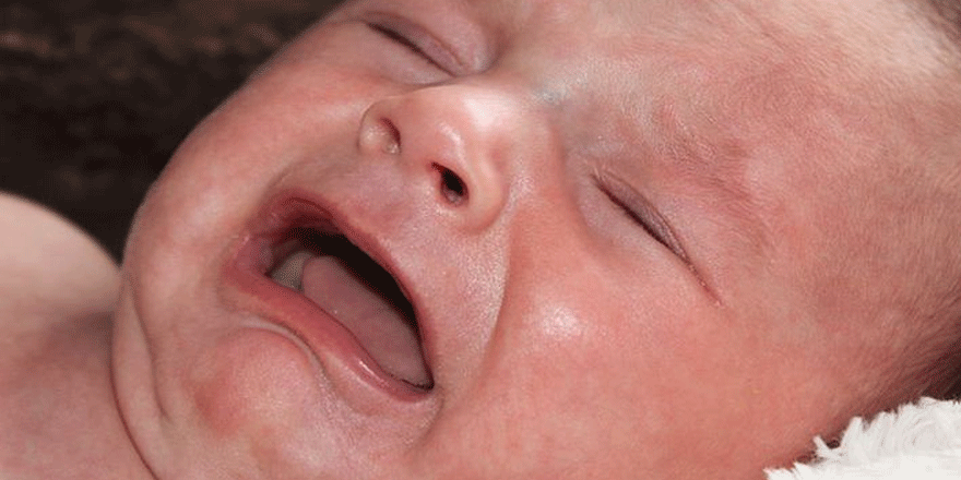 Probiyotik kolikli bebeklerde ağlama süresini azaltıyor