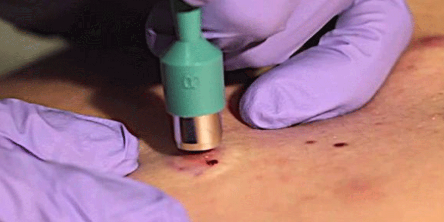 Türk bilim insanları biyopsi yapabilen kapsül robot geliştirdi