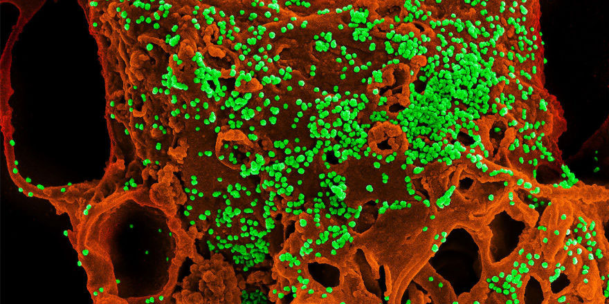 Gizemli virüs'ten etkilenenlerin sayısı 140'a çıktı