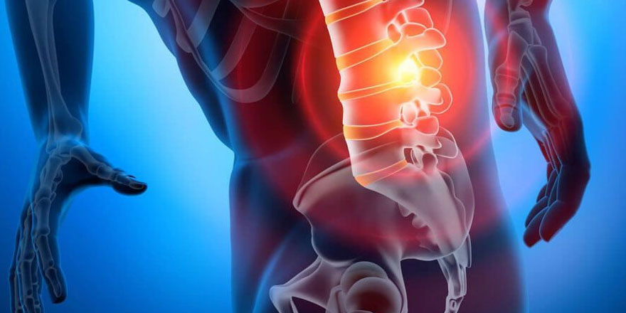 Bel fıtığı ameliyatsız yöntemlerle tedavi edilebiliyor