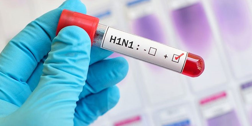 Ordu’daki ölümün domuz gribinden olduğu kesinleşti