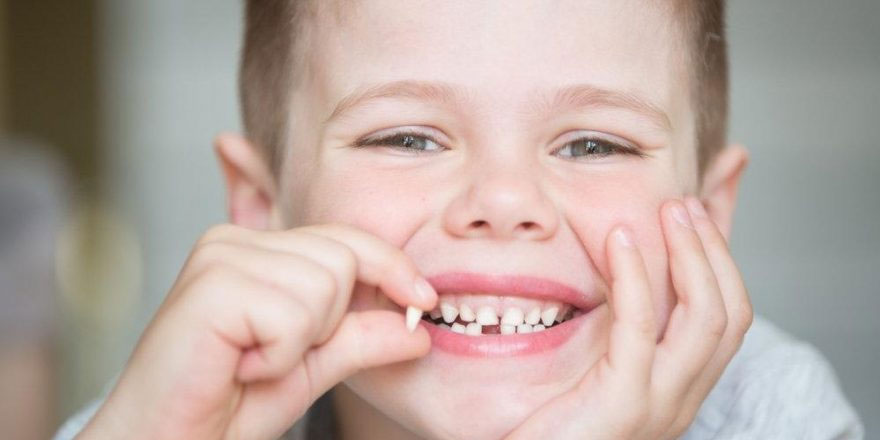 Süt dişleri çekilmeli mi?