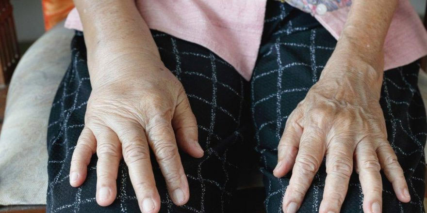 Albumin düşüklüğü ne anlama gelir?