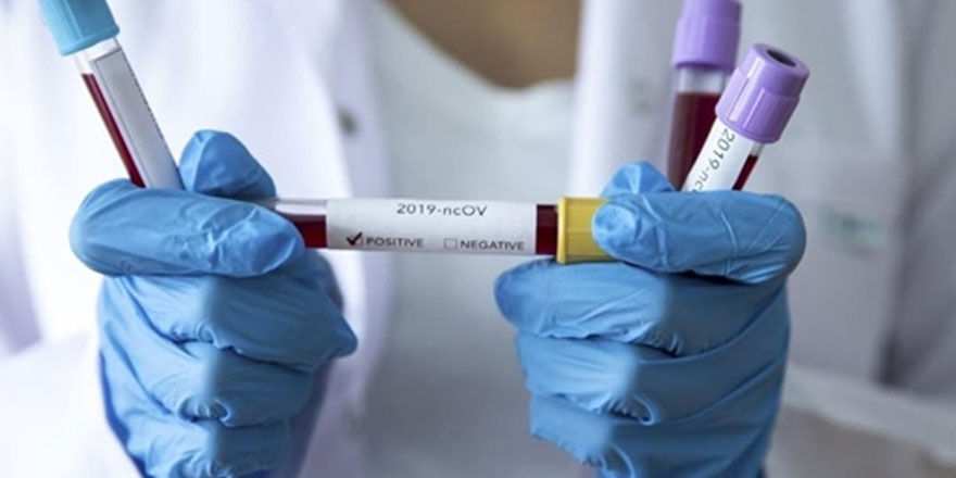 İran’dan korkutan corona açıklaması: 13 yeni vaka daha tespit edildi