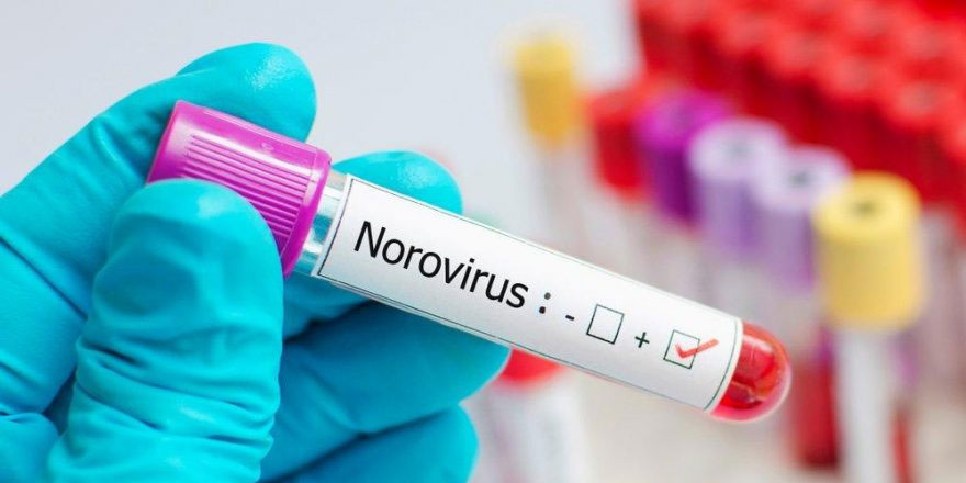 Norovirüs enfeksiyonu nedir?