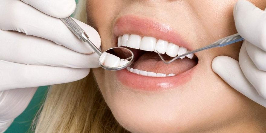 Porselen diş kaplama nedir?