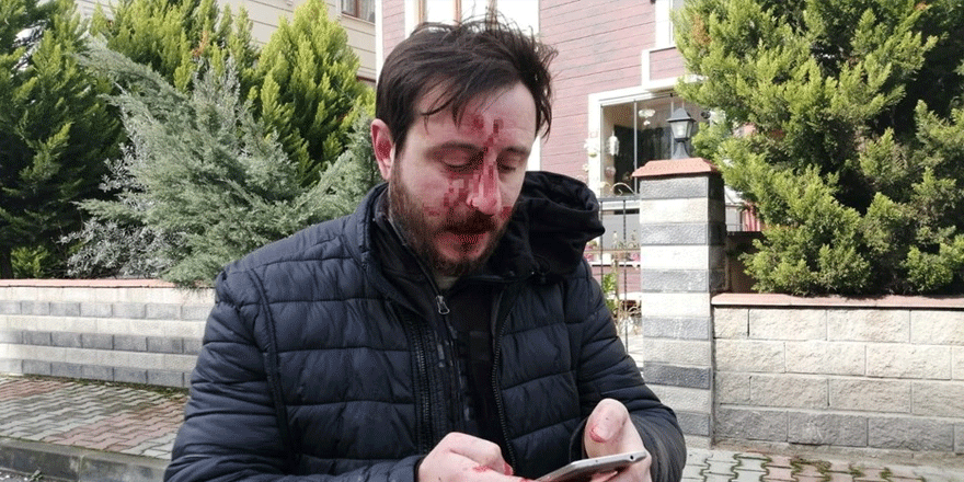 Komşuların gürültü kavgası kanlı bitti: 3 yaralı